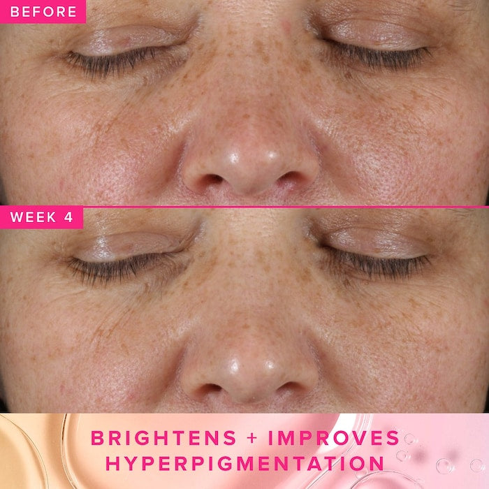 Farmacy Brighten Up 3% TXA Dark Spot Toner 120 ml