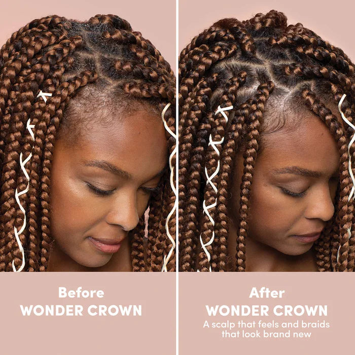 Mizani Wonder Crown Clarifying Scalp Treatment 200 ml