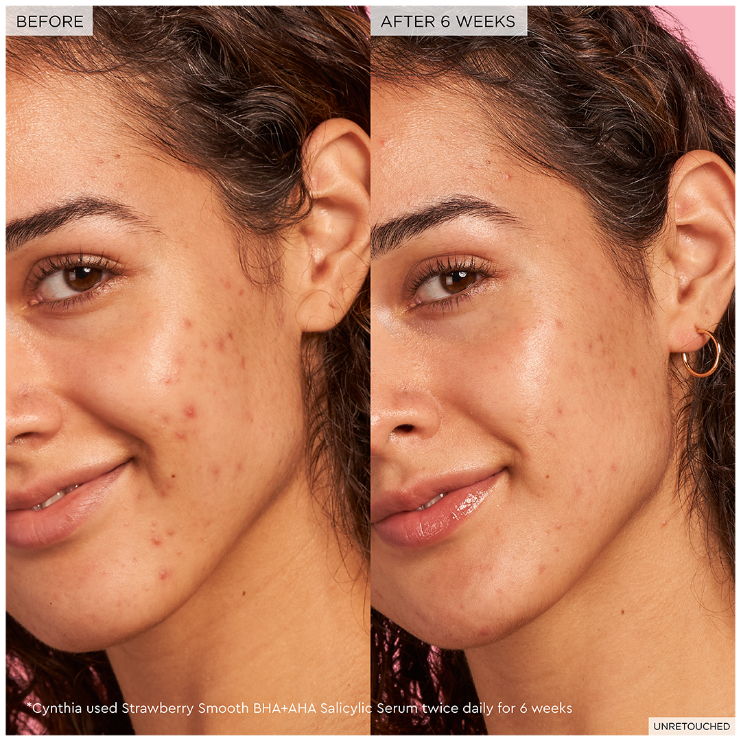 Glow Recipe Strawberry Smooth BHA + AHA Salicylic Acid Serum 30 ml