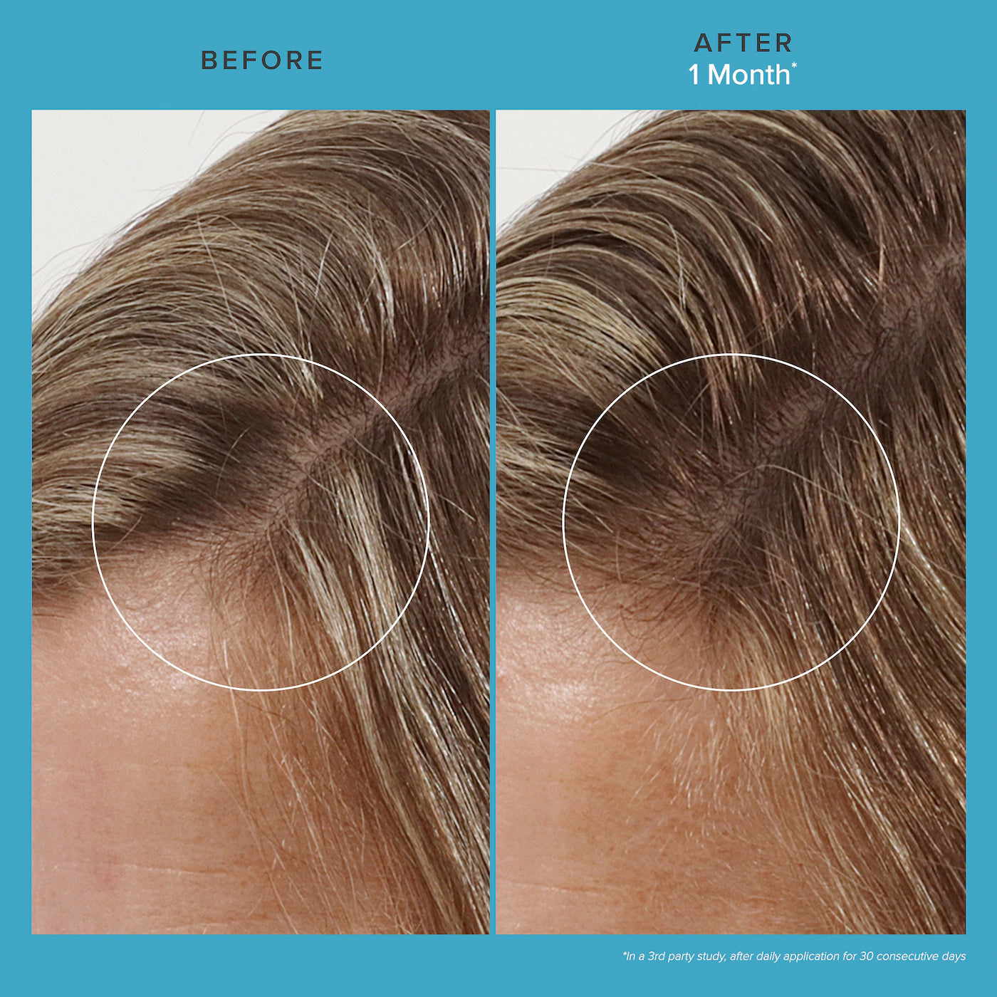 Living Proof Scalp Care Revitalizing Treatment 73 ml