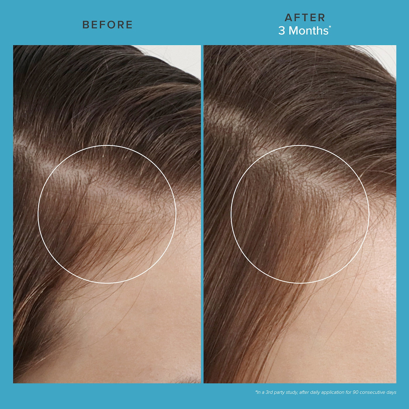 Living Proof Scalp Care Revitalizing Treatment 73 ml