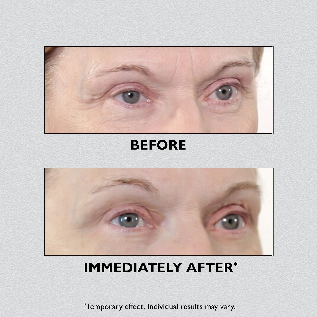 Peter Thomas Roth Instant FIRMx® Eye Temporary Eye Tightener 30 ml